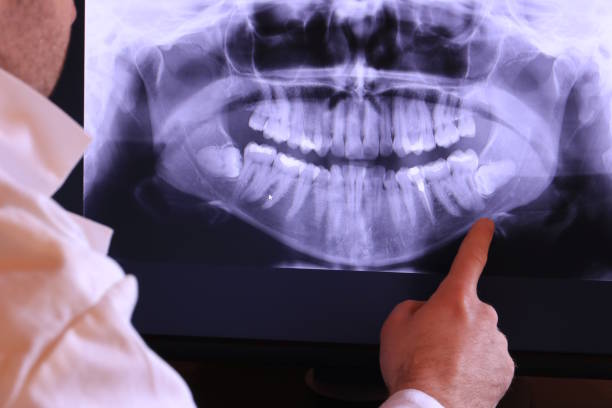 Best Weekend Emergency Dentist in Port Carbon, PA