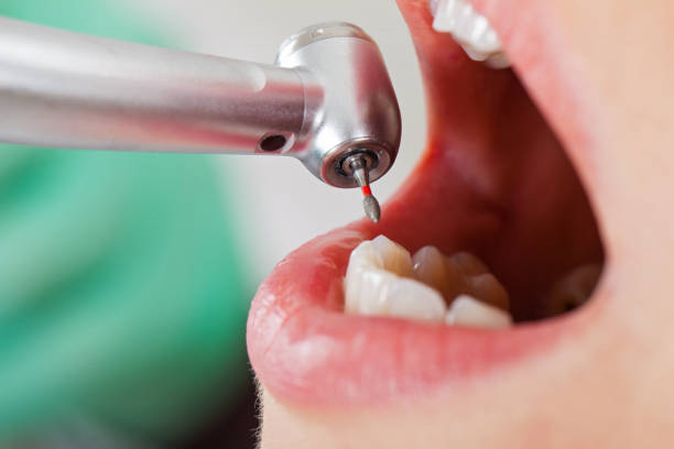 Best Pediatric Emergency Dentist in Port Carbon, PA